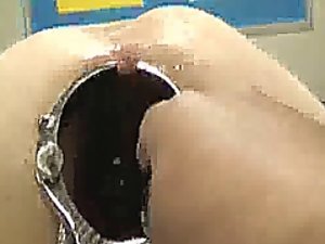 Mengejutkan spekulum anal menganga dan fisting
