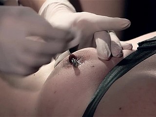 Ep. 24 Aguja tortura